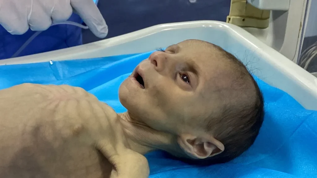 Gázai ma nem kevesebb, mint egy náci koncentrációs tábor 5 2024 03 28T111932Z 995196966 RC2T 6DP RTRMADP 3 ISRAEL PALESTINIANS