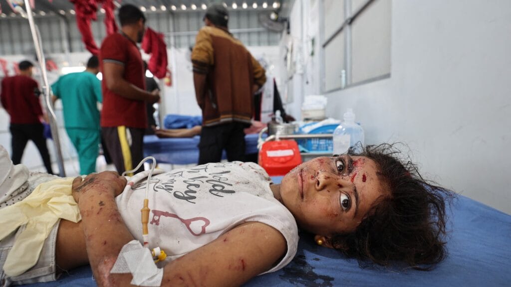 Egy második Nakba, televízióban. 5 A wounded girl receives treatment at Al Awda Hospital at the Nuseirat refugee camp in the central Gaza Strip following an Israeli airstrike that hit a school in the camp on May 19 2025 afp