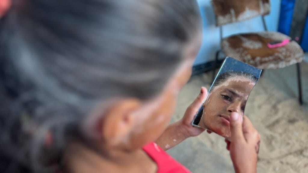„Idős gyermek”: Az izraeli bombázás traumája megőszítette egy gázai kislány haját 6 IMG 8870 1