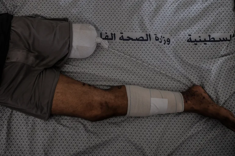 GettyImages-1781617681-1712145516