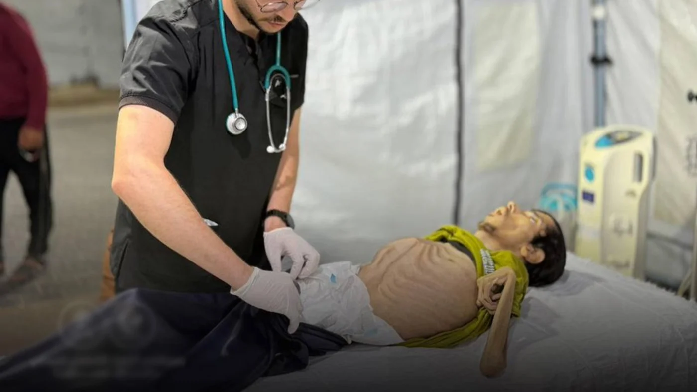 gaza-man-dies-malnutrition-israel-siege-kuwait-hospital-july-2025.jpg