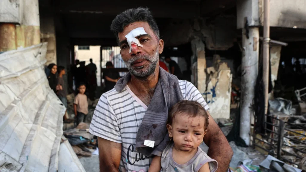 gaza palestine israel injured shelter gaza city september 2025 afp 0.jpg