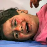 gaza-nuseirat-injured-child-may-2025-eyad-baba-afp.jpg