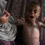 palestine-malnutrition-gaza-al-shati-july-2025-omar-al-qattaa-afp.jpg