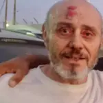 Izraeli erők szabadon engedtek egy palesztin „szegények orvosát”, akin bántalmazás nyomai látszottak. Screen Shot 2026-10-25 at 21.59.12.jpeg